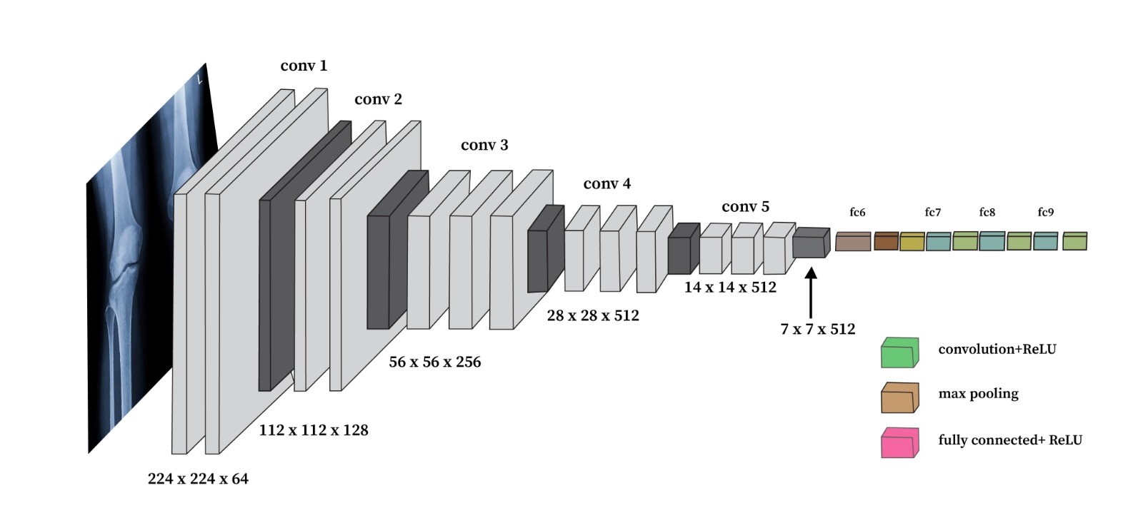 Comparative Analysis of Automated Knee Osteoarthritis Severity Classification from X-Ray Images Using CNNs and VGG16 Architecture